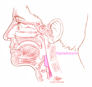Cáncer de hipofaringe - Etapas, síntomas y pronóstico. Opciones de tratamiento, Labex Trade
