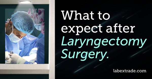 Qué esperar después de la cirugía de laringectomía, Labex Trade